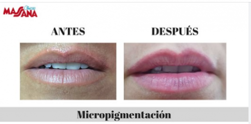 Ates y despu�s micropigmentaci�n labios